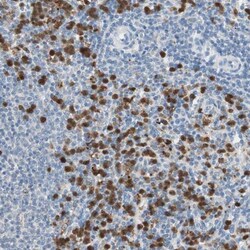 CLEC4D/CLECSF8 Antibody, Novus Biologicals 25 &mu;L | Buy Online | Novus Biologicals | Fisher Scientific